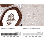 WFDC2 Antibody in Immunohistochemistry (Paraffin) (IHC (P))
