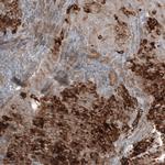WFDC2 Antibody in Immunohistochemistry (Paraffin) (IHC (P))