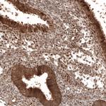 WFDC2 Antibody in Immunohistochemistry (Paraffin) (IHC (P))