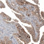 WFDC2 Antibody in Immunohistochemistry (Paraffin) (IHC (P))