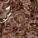 WFDC2 Antibody in Immunohistochemistry (Paraffin) (IHC (P))
