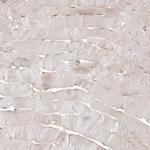 WFDC2 Antibody in Immunohistochemistry (Paraffin) (IHC (P))