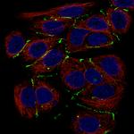 Claudin 3 Monoclonal Antibody (CL13130)