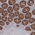 Claudin 3 Antibody in Immunohistochemistry (Paraffin) (IHC (P))