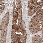 Claudin 3 Antibody in Immunohistochemistry (Paraffin) (IHC (P))