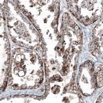 Claudin 3 Antibody in Immunohistochemistry (Paraffin) (IHC (P))