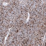 Claudin 3 Antibody in Immunohistochemistry (Paraffin) (IHC (P))