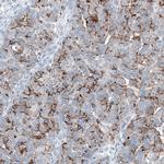 Claudin 3 Antibody in Immunohistochemistry (Paraffin) (IHC (P))