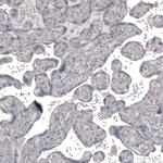 Claudin 3 Antibody in Immunohistochemistry (Paraffin) (IHC (P))