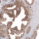 Claudin 3 Antibody in Immunohistochemistry (Paraffin) (IHC (P))