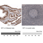 WT1 Antibody in Immunohistochemistry (Paraffin) (IHC (P))