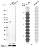 WT1 Antibody in Western Blot (WB)