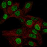WT1 Monoclonal Antibody (CL13176)