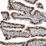 WT1 Antibody in Immunohistochemistry (Paraffin) (IHC (P))