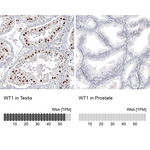 WT1 Antibody in Immunohistochemistry (Paraffin) (IHC (P))
