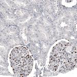 WT1 Antibody in Immunohistochemistry (Paraffin) (IHC (P))