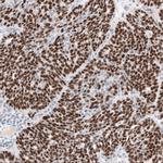 WT1 Antibody in Immunohistochemistry (Paraffin) (IHC (P))