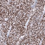 WT1 Antibody in Immunohistochemistry (Paraffin) (IHC (P))