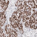 WT1 Antibody in Immunohistochemistry (Paraffin) (IHC (P))