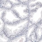 WT1 Antibody in Immunohistochemistry (Paraffin) (IHC (P))