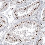 WT1 Antibody in Immunohistochemistry (Paraffin) (IHC (P))