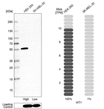 WT1 Antibody in Western Blot (WB)