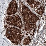 GSPT1 Antibody in Immunohistochemistry (Paraffin) (IHC (P))