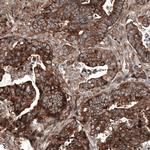 GSPT1 Antibody in Immunohistochemistry (Paraffin) (IHC (P))