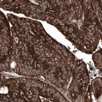 GSPT1 Antibody in Immunohistochemistry (Paraffin) (IHC (P))