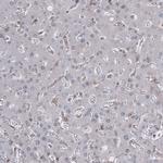GSPT1 Antibody in Immunohistochemistry (Paraffin) (IHC (P))