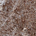 GSPT1 Monoclonal Antibody (CL13332)