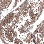 GSPT1 Antibody in Immunohistochemistry (Paraffin) (IHC (P))