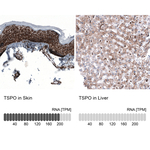 TSPO Antibody in Immunohistochemistry (Paraffin) (IHC (P))