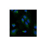 LPL Monoclonal Antibody (5D2), HRP