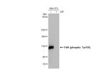 Phospho-FAK (Tyr576) Recombinant Rabbit Monoclonal Antibody (HL127)