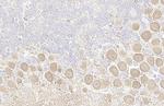 Phospho-PKC zeta (Thr410) Antibody in Immunohistochemistry (Paraffin) (IHC (P))