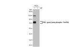 Phospho-PKC zeta (Thr410) Antibody in Western Blot (WB)