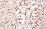 Phospho-ErbB2 (HER-2) (Tyr1248) Antibody in Immunohistochemistry (Paraffin) (IHC (P))