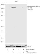 Phospho-ErbB2 (HER-2) (Tyr1248) Antibody