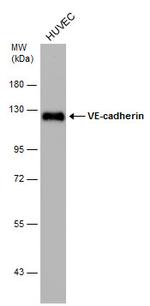 VE-cadherin Antibody in Western Blot (WB)