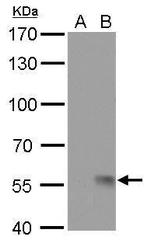 Influenza A H1N1 NA (A/WSN/1933) Monoclonal Antibody (GT172)