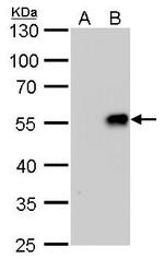 Influenza A H1N1 NA (A/WSN/1933) Monoclonal Antibody (GT288)