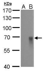 Influenza A H1N1 HA (A/WSN/1933) Monoclonal Antibody (GT521)