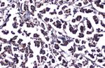 ATM Recombinant Rabbit Monoclonal Antibody (2C1-RB)