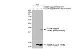 TREM2 (R47H Mutant) Recombinant Rabbit Monoclonal Antibody (HL1032)