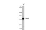 POLR2B Recombinant Rabbit Monoclonal Antibody (HL1043)