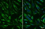 SDHA Recombinant Rabbit Monoclonal Antibody (HL1067)