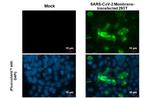 SARS-CoV-2 Membrane Recombinant Rabbit Monoclonal Antibody (HL1088)