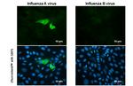 Influenza A H1N1 NA (A/WSN/1933) Recombinant Rabbit Monoclonal Antibody (HL1108)