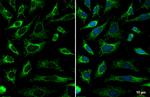 SDHA Recombinant Rabbit Monoclonal Antibody (HL1117)